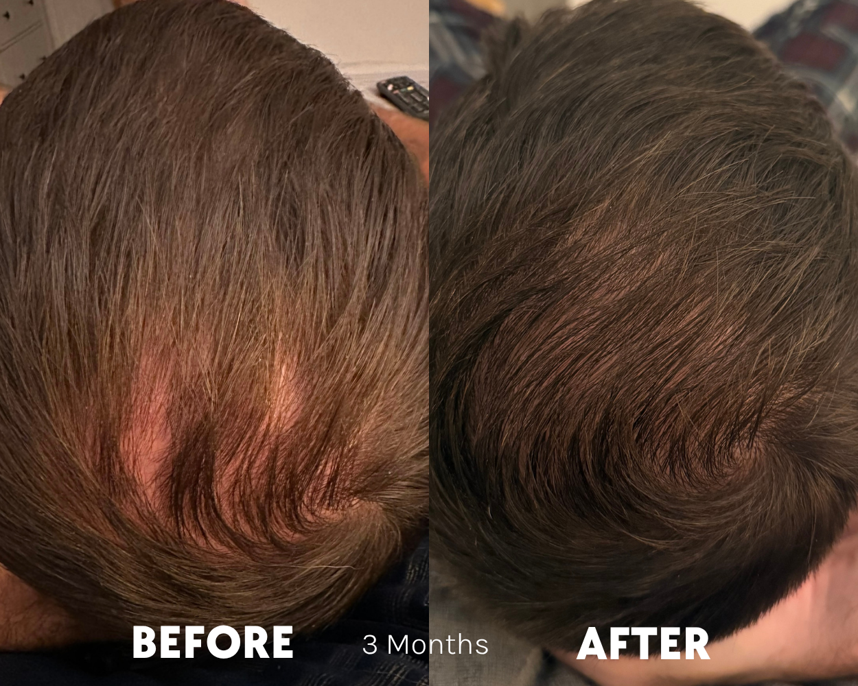 Before and after — Daniel W., month 3